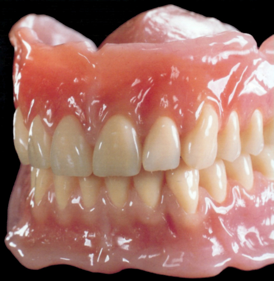 入れ歯治療の種類 - エース歯科（北群馬郡吉岡町）